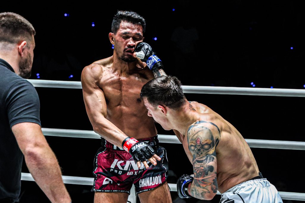 เหตุใดเกมรับจึงเป็นหนึ่งในจุดเด่นของมวยสากลอาร์เจนตินา